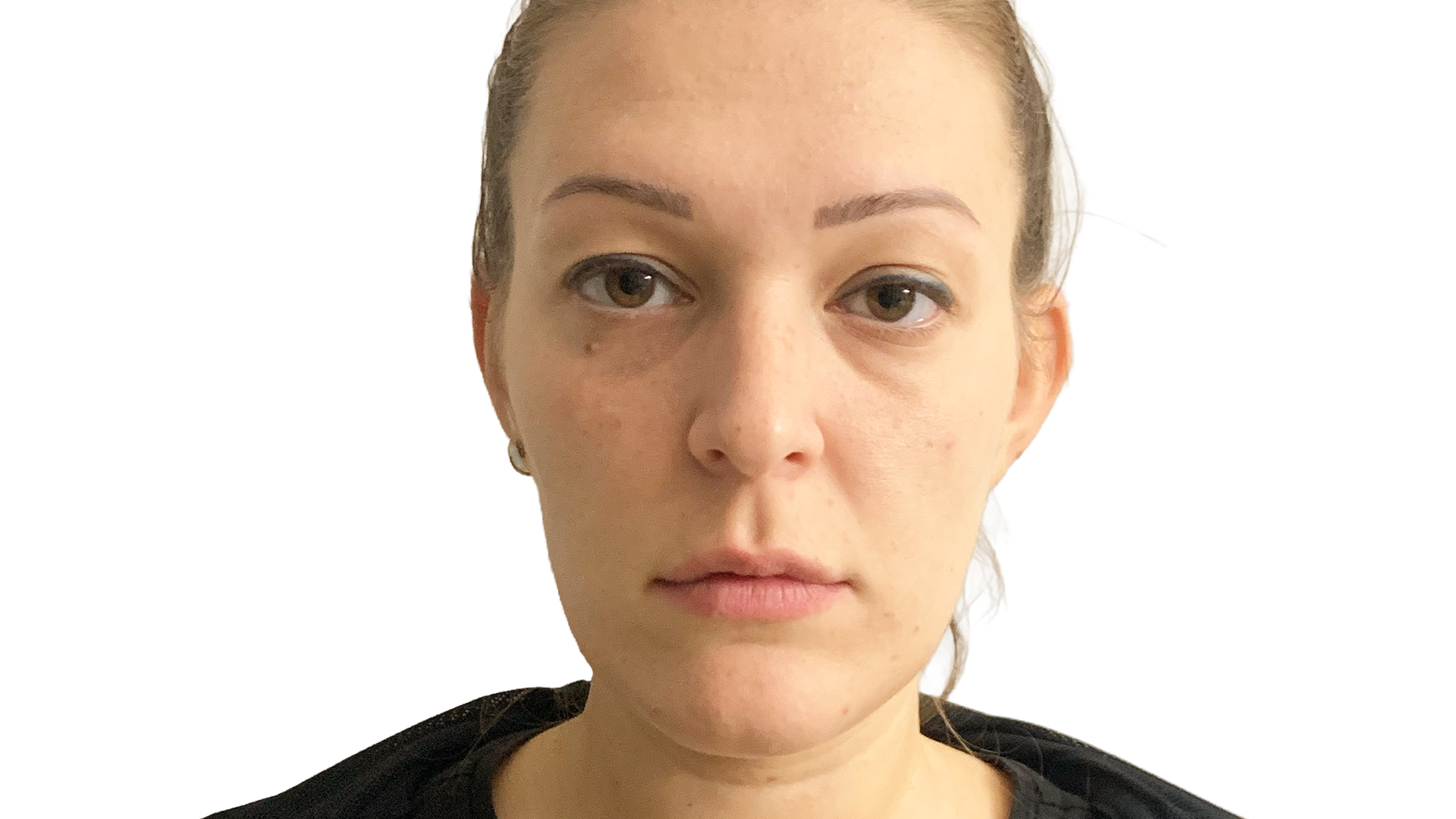 Longevity Flow Giulia Ferraioli Before 01